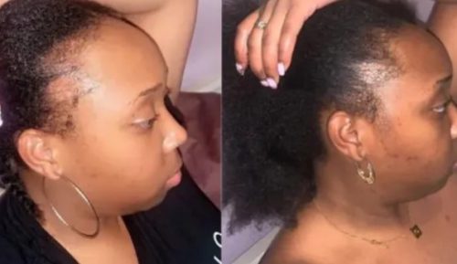 Batana Natural Hair Growth Oil photo review