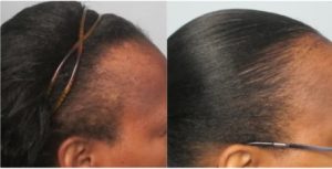 Batana Natural Hair Growth Oil photo review