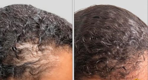 Batana Natural Hair Growth Oil photo review